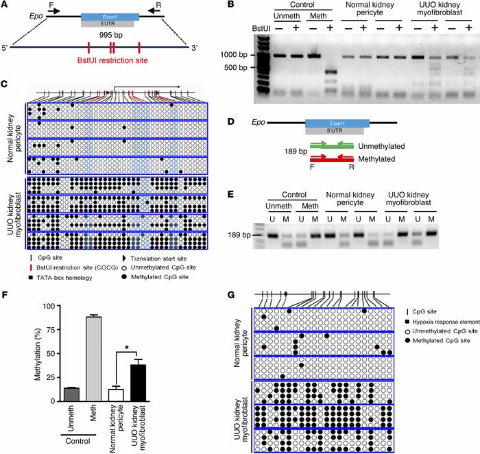 Hypermethylation of EPO 5′-regulatory elements in kidney myofibroblasts....