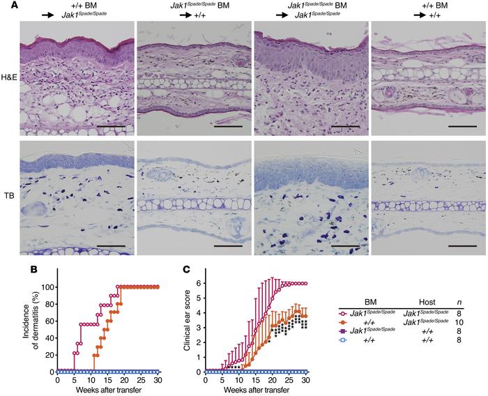 Dermatitis development in BM-transferred mice.
(A) Photomicrographs show...