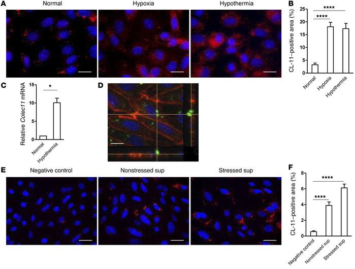 Renal tubule cell stress mediates CL-11 expression.
(A) Representative i...