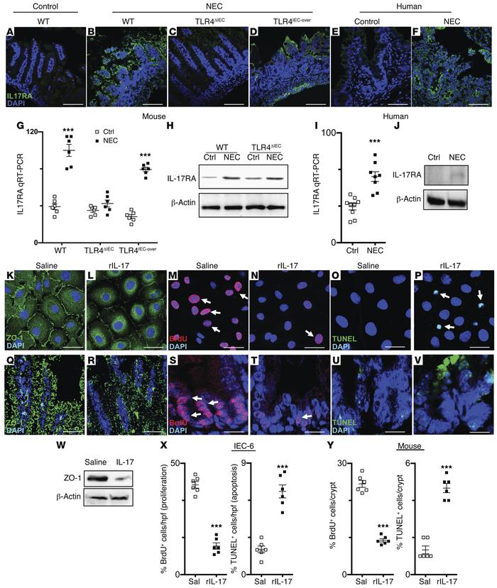 TLR4-dependent release of IL-17 during NEC causes intestinal mucosal inj...