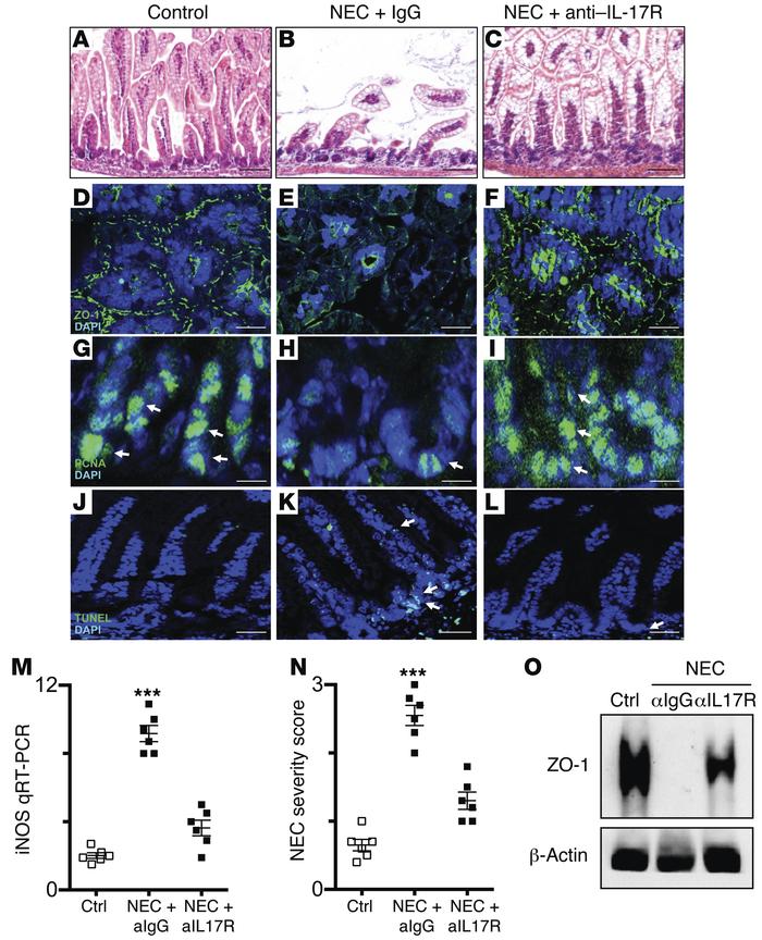 Inhibition of IL-17R reverses mucosal damage in NEC in mice.
(A–L) WT mi...
