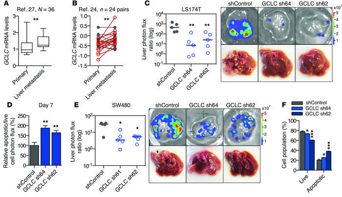 GCLC, the rate-limiting enzyme in glutathione synthesis, promotes liver ...