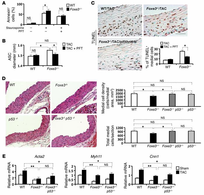Aortic developmental defects and aberrant aortic remodeling with TAC in ...