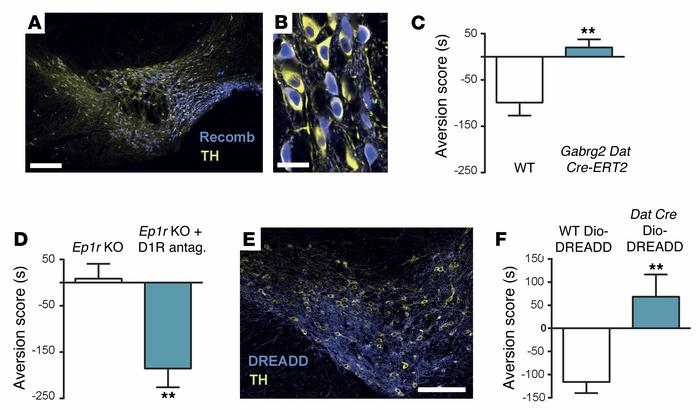 Inflammation induces aversion by inhibiting dopaminergic signaling.
(A a...