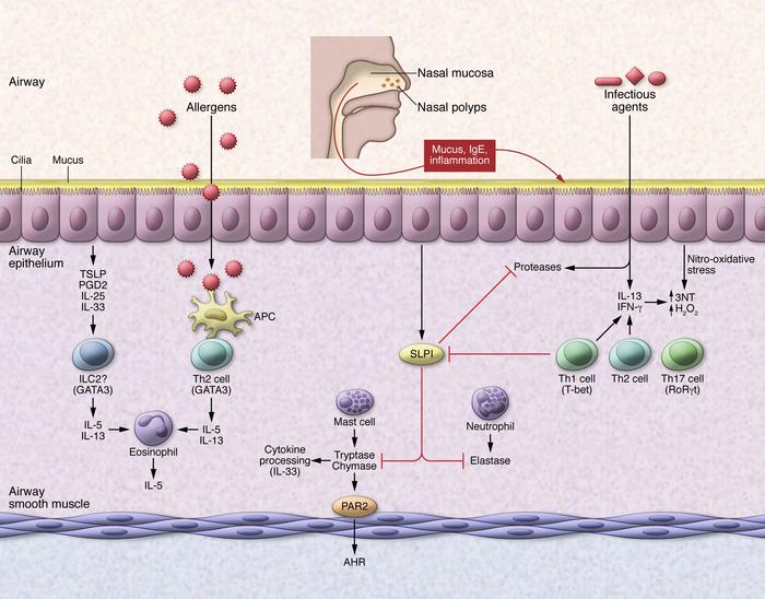 Environmental influence on severe asthma and a complex relationship amon...