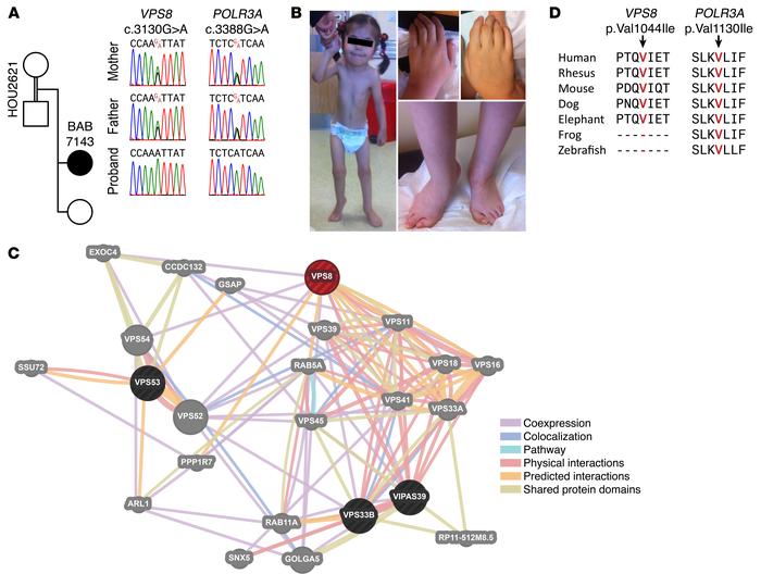 Homozygous VPS8 and POLR3A variants identified in BAB7143.
(A) Segregati...