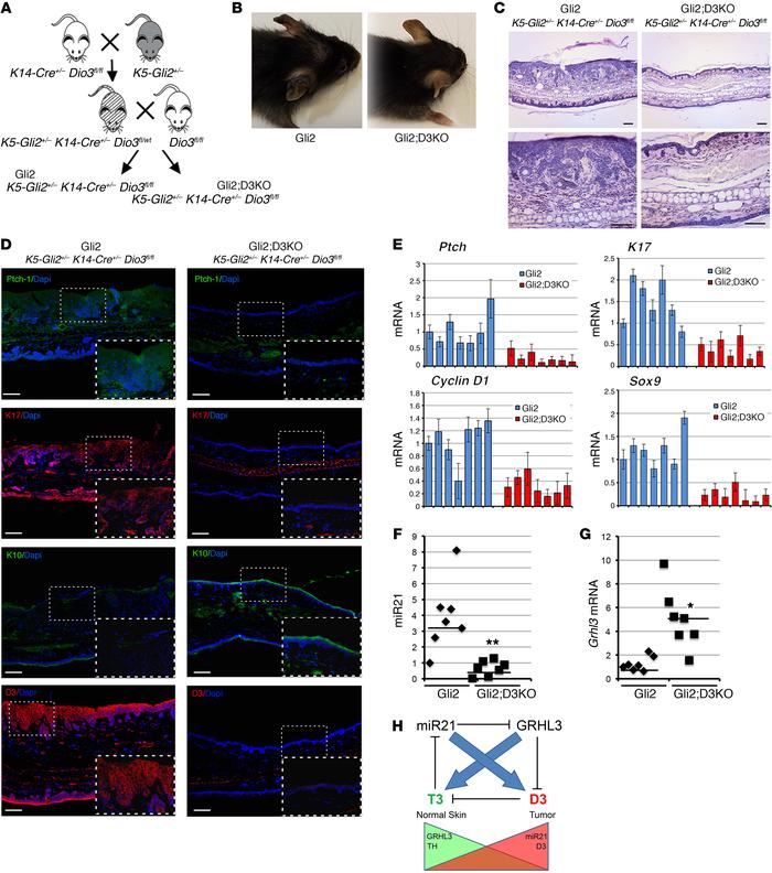 Epidermal D3 depletion significantly reduces Gli2-driven BCC-like tumor ...