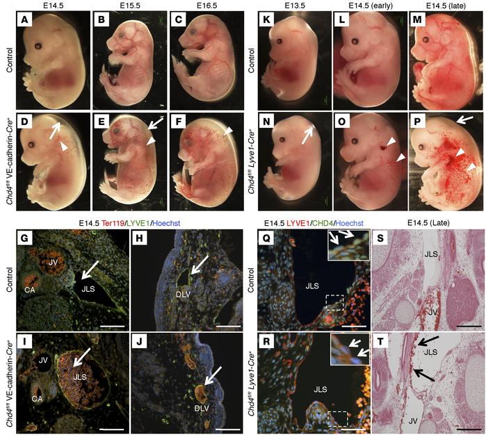 
Chd4fl/fl VE-cadherin-Cre+ and Chd4fl/fl Lyve1-Cre+ embryos display ede...