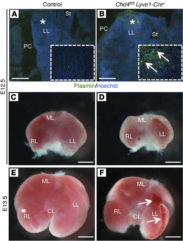 Plasmin activity is increased prior to hemorrhage in Chd4fl/fl Lyve1-Cre...