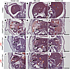 Fatal liver hemorrhage in Chd4fl/fl Lyve1-Cre+ mutants is ameliorated with