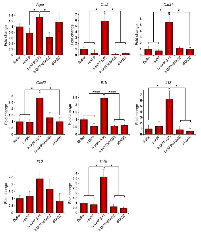 sRAGE inhibits h-IAPP–induced inflammatory gene expression in β cells.
q...