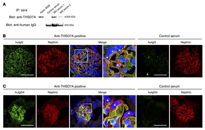 Human anti-THSD7A antibodies bind to mouse THSD7A in vitro and in vivo.
...