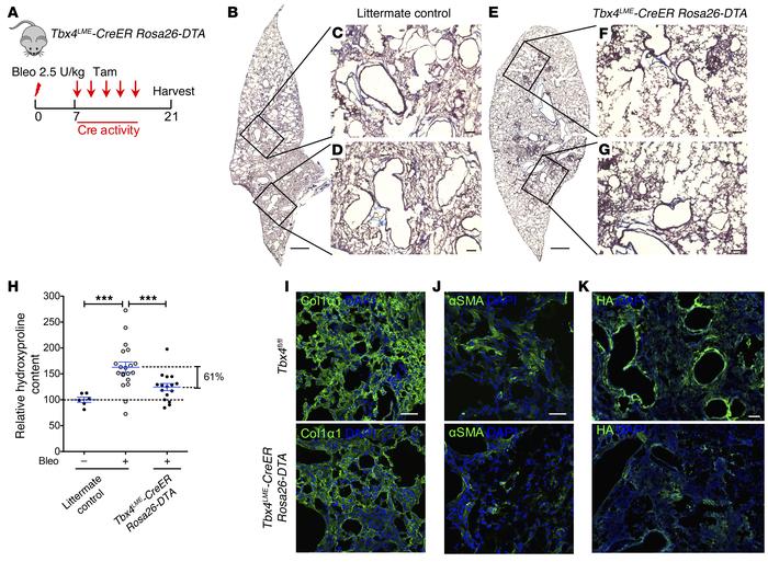 Ablation of TBX4 cells attenuates pulmonary fibrosis.
(A) Strategy for i...