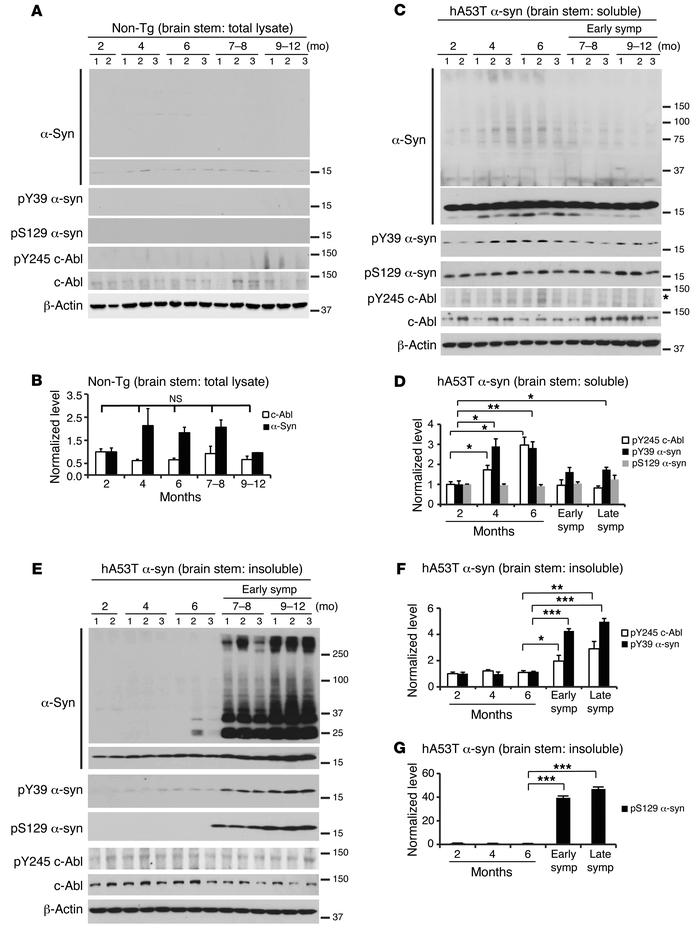 Phosphotyrosine 39 α-synuclein increases in the brain stem of hA53Tα-syn...