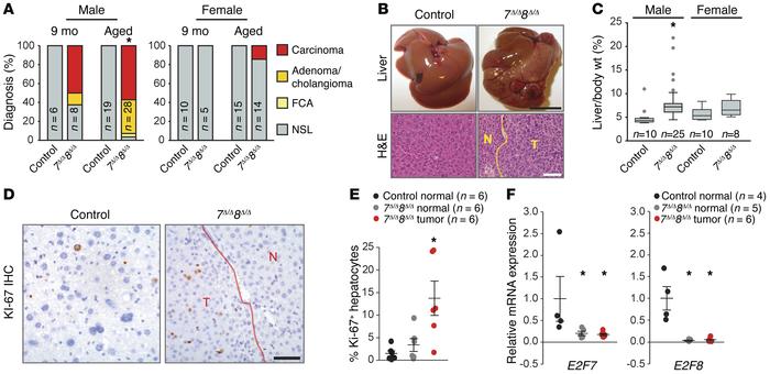 Loss of atypical E2Fs in hepatocytes leads to spontaneous HCC.
(A) Histo...