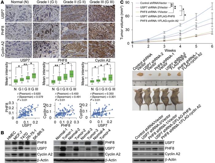 USP7/PHF8/cyclin A2 signaling pathway promotes breast carcinogenesis.
(A...