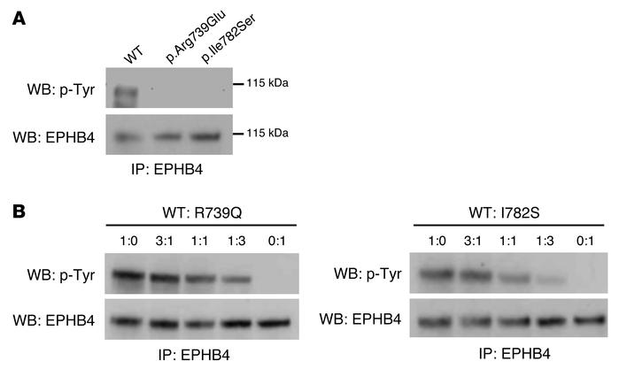 Effect of p.Arg739Glu and p.Ile782Ser mutations on EPHB4 tyrosine phosph...