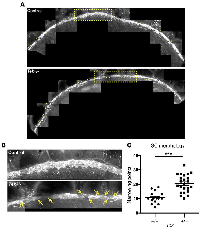 Quantitative analysis of SC morphology.
(A) Confocal microscopic images ...