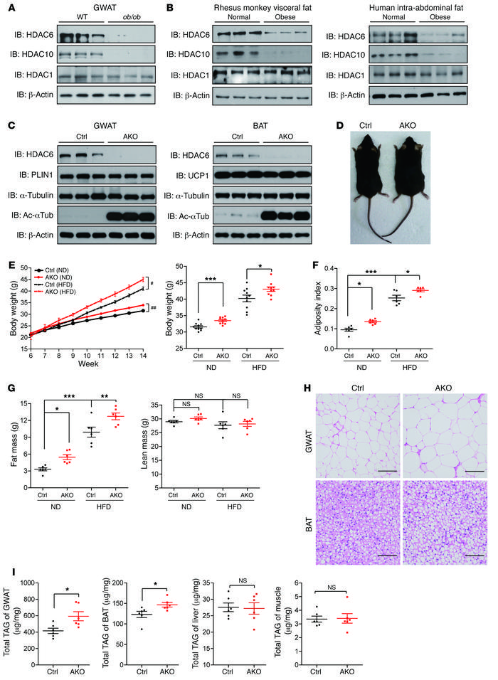 HDAC6 is a negative regulator of lipid storage.
(A) Levels of HDAC6 and ...