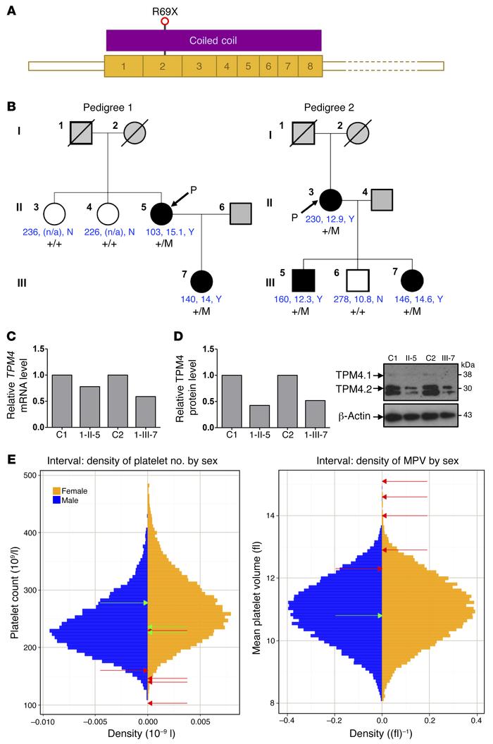 
TPM4 mutation causes macrothrombocytopenia in humans.
(A) Schematic rep...