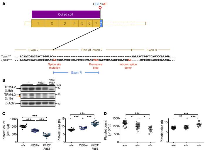 Loss of function at the Tpm4 locus causes macrothrombocytopenia in mice....