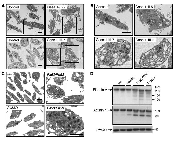 TPM4 insufficiency results in altered platelet morphology.
(A and B) Ult...