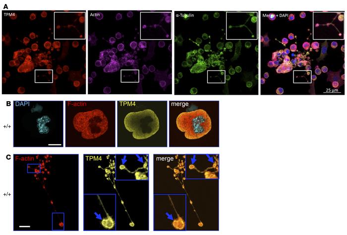 TPM4 localizes to proplatelets in human and mouse megakaryocytes.
(A) Im...