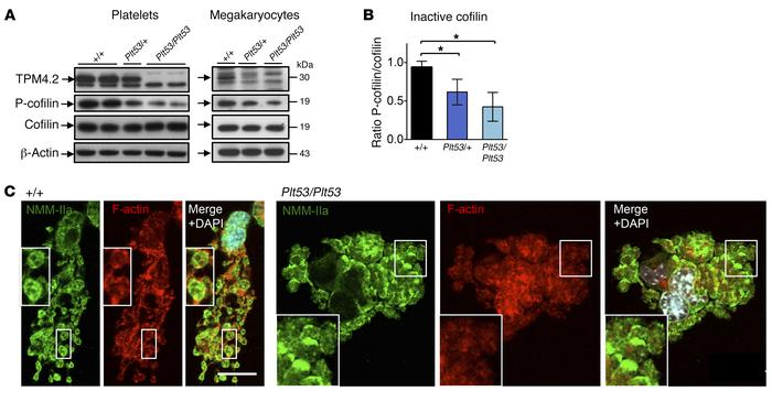 TPM4-interacting proteins in megakaryocytes and platelets.
(A) Investiga...