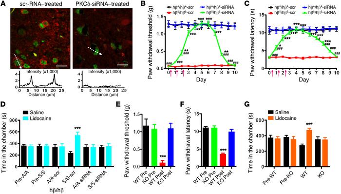 Sickle cell pain behaviors in mice after neuronal PKCδ silencing and in ...