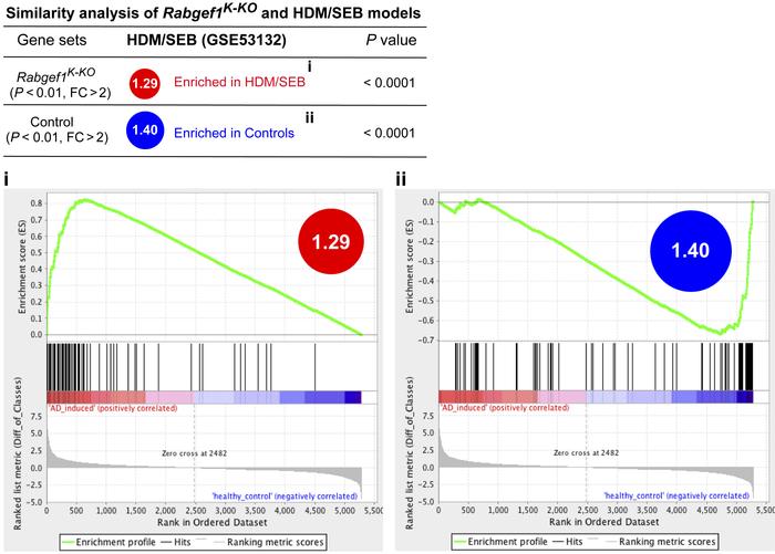 GSEA between Rabgef1K-KO and HDM/SEB mouse models.
Gene set enrichment a...