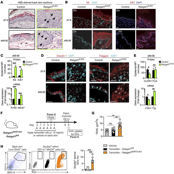 Epidermal abnormalities and barrier dysfunction in mice with deletion of...