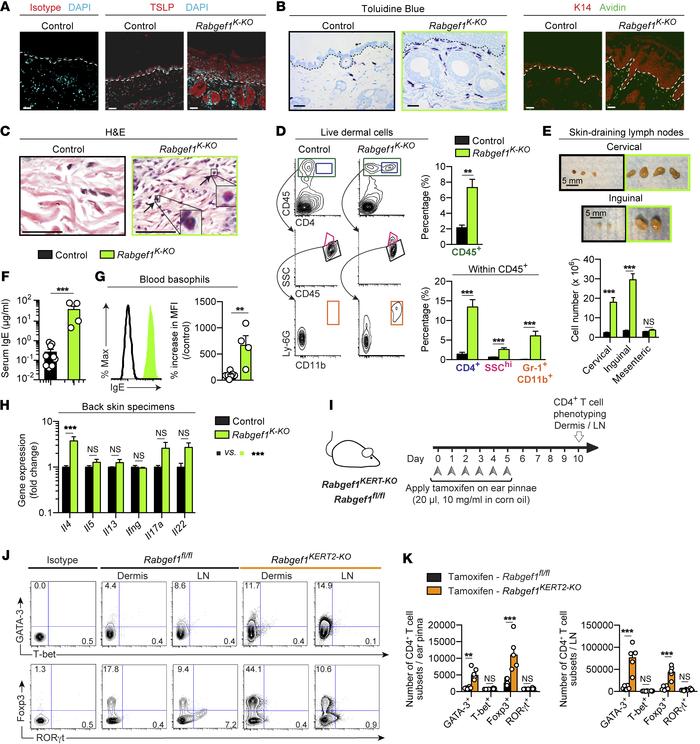 Type 2 cutaneous inflammation and elevated serum IgE in adult Rabgef1K-K...