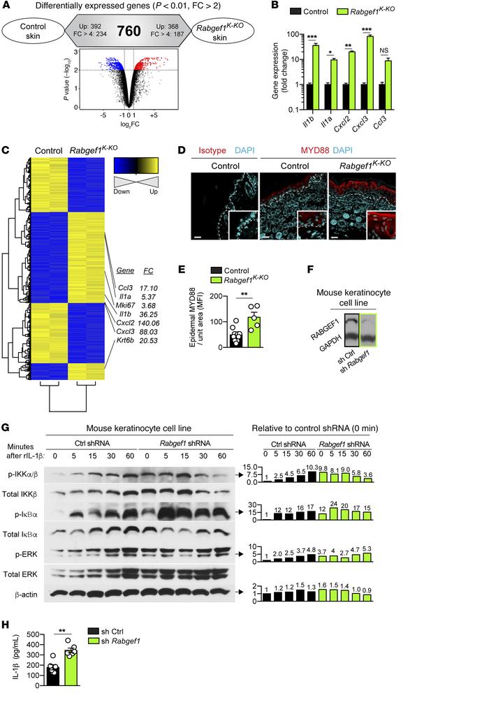 Increased activation of the IL-1R/MYD88/NF-κB pathway in RABGEF1-deficie...