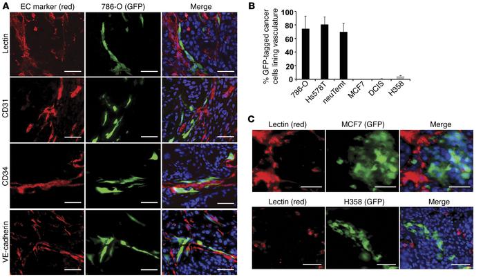 Mesenchymal cancer cells are associated with endothelial vasculature in ...