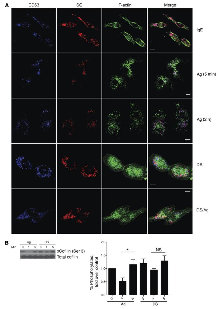 Distinct actin reorganization in desensitized cells.
(A) Serglycin (SG)–...