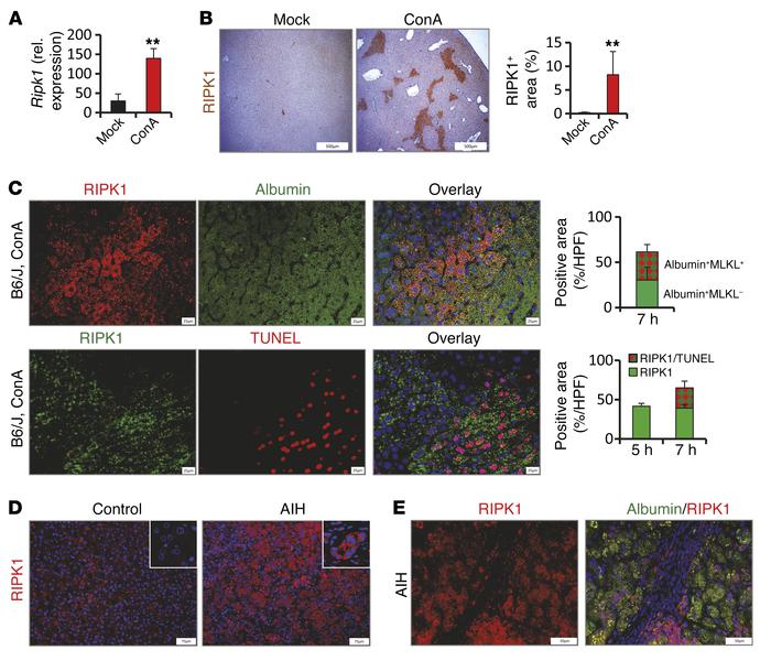 RIPK1 is upregulated during experimentally induced hepatitis and in huma...