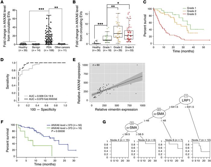 ANXA6+ EVs are a biomarker for pancreatic cancer.
(A) Quantification of ...