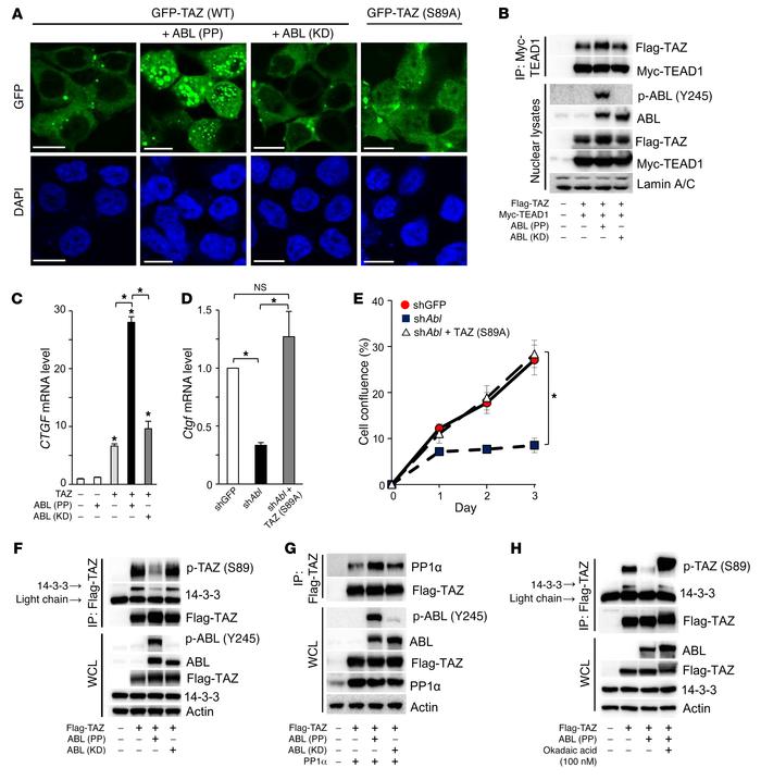 ABL stabilizes the TAZ-TEAD complex required for osteoblast expansion.
(...