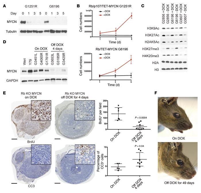 Sustained MYCN expression is initially required for retinoblastoma cell ...