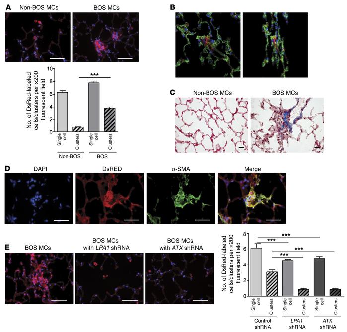 In vivo fibrotic behavior of human BOS MCs after adoptive transfer demon...