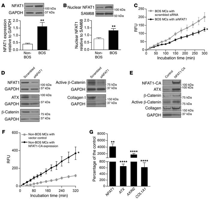 NFAT1 regulates ATX, β-catenin, and collagen I expression in lung MCs.
(...