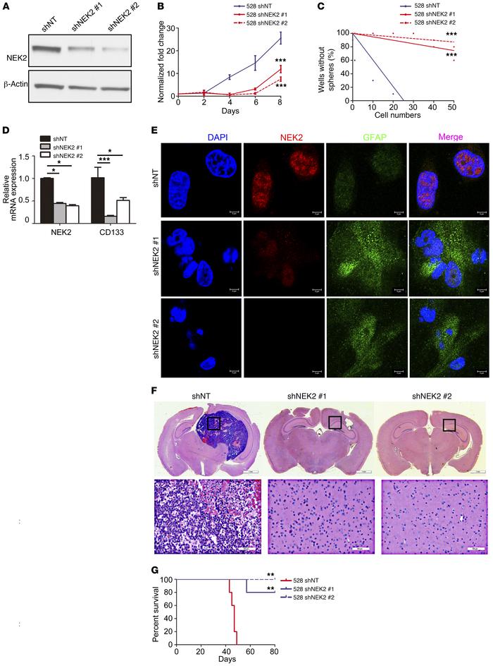 NEK2 silencing reduces GSC self-renewal in vitro and tumorigenesis in vi...