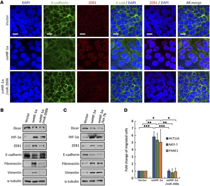 Functional roles of HIF-1α–induced miR-200b suppression in EMT.
(A–D) Ro...