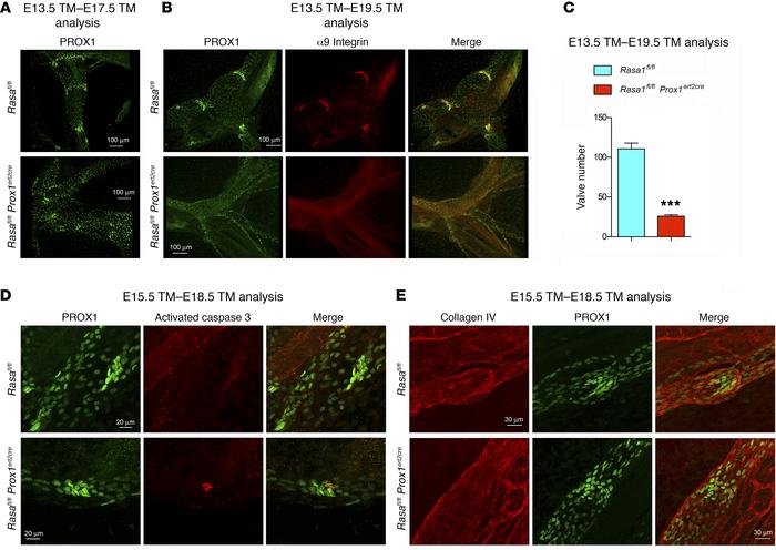 Specific loss of RASA1 in LECs results in impaired LV valve development....