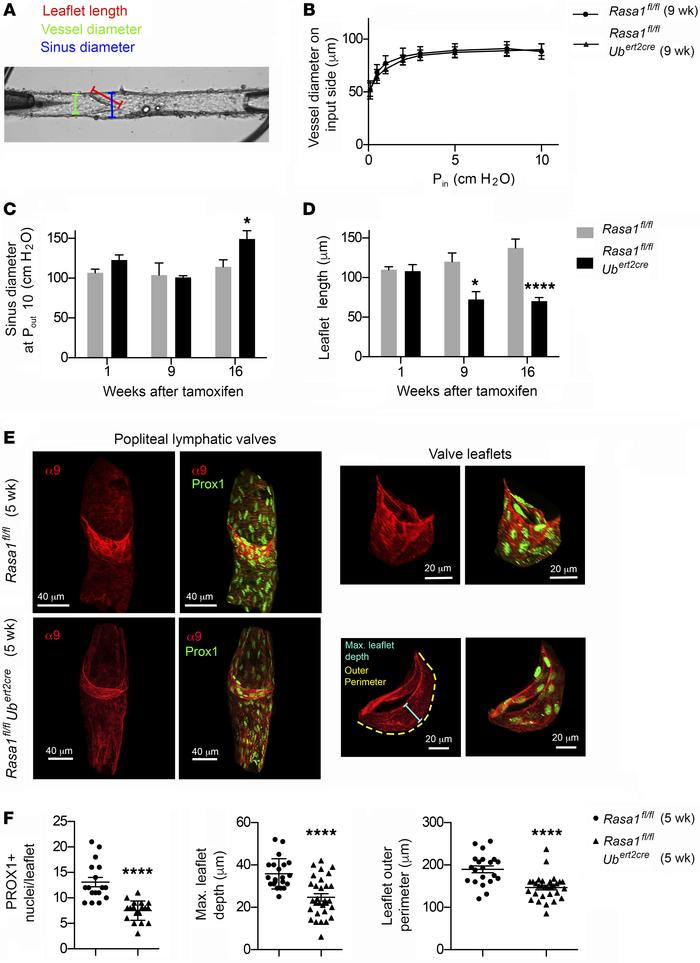 LV valve leaflet atrophy associated with reduced numbers of leaflet PROX...