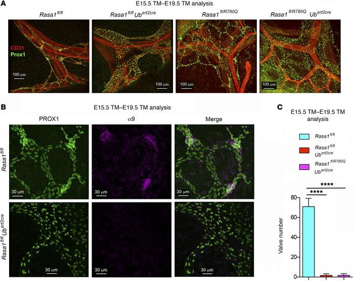 Blocked LV valve development in induced RASA1-deficient and induced Rasa...