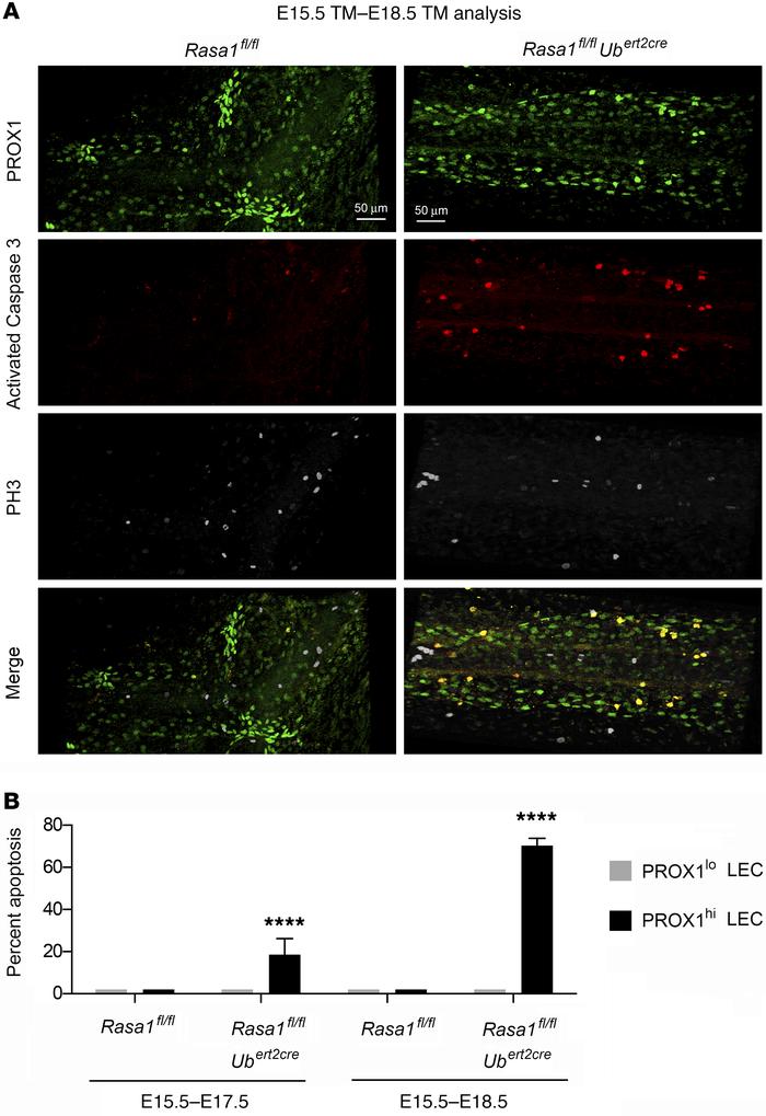 Apoptosis of PROX1hi LECs in developing LV valves of induced RASA1-defic...