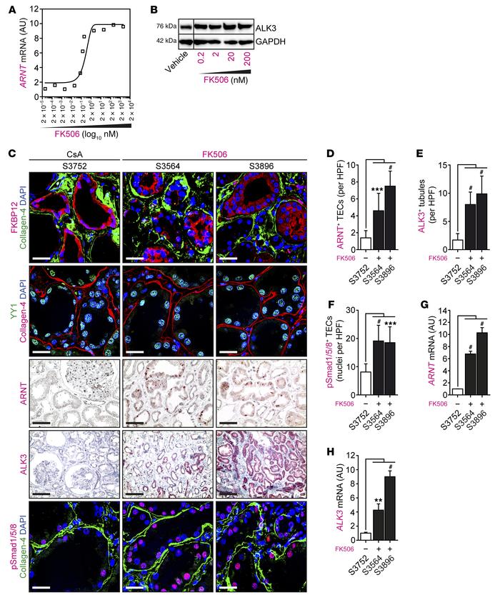 An FKBP12/YY1/ARNT signaling axis translates to humans.
(A) Human TEC cu...