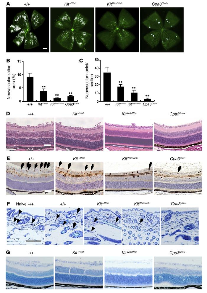 Mast cell deficiency prevented in the development of retinal neovascular...