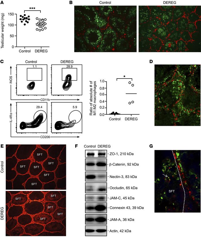 EAO of Treg-depleted DEREG mice is characterized by M1-like macrophage i...